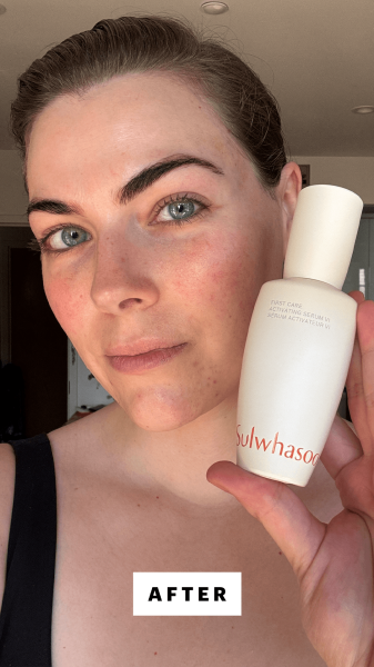 Dall'Asen after applying the Sulwhasoo First Care Activating Serum